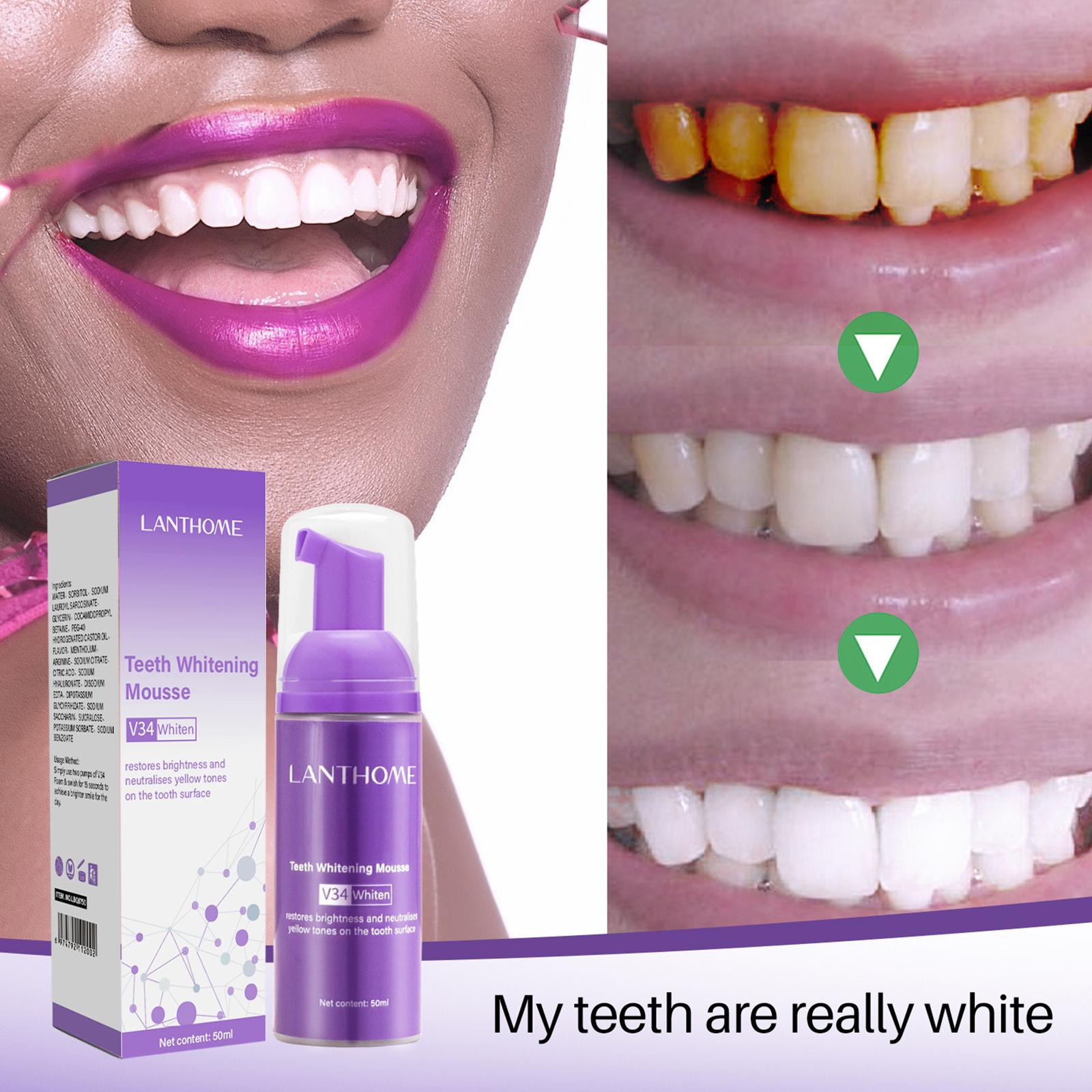 V34 Mousse Teeth Cleaning Toot - đánh giá và giá Teeth Whitening At Home