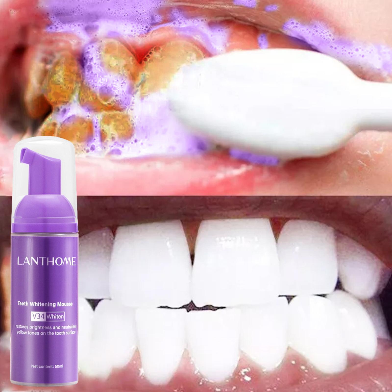 V34 Mousse Teeth Cleaning Toot - đánh giá và giá Teeth Whitening At Home