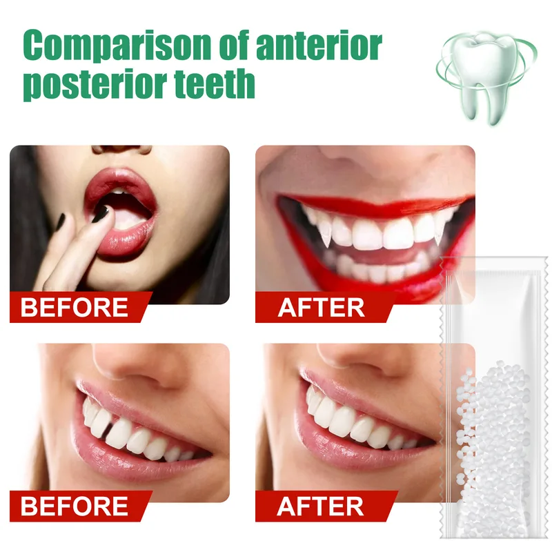 10g50g/30ml Resin Tooth Repair - đánh giá và giá Teeth Whitening At Home