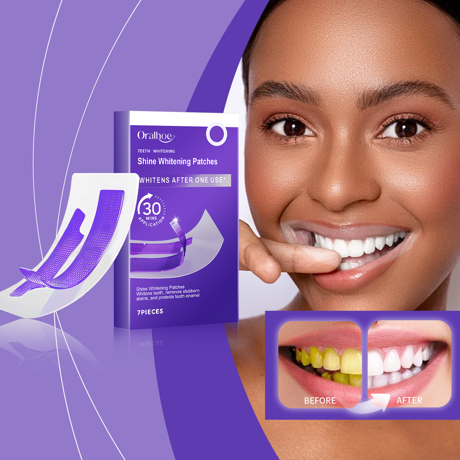 Purple Teeth Whitening Strips  - đánh giá và giá Teeth Whitening At Home