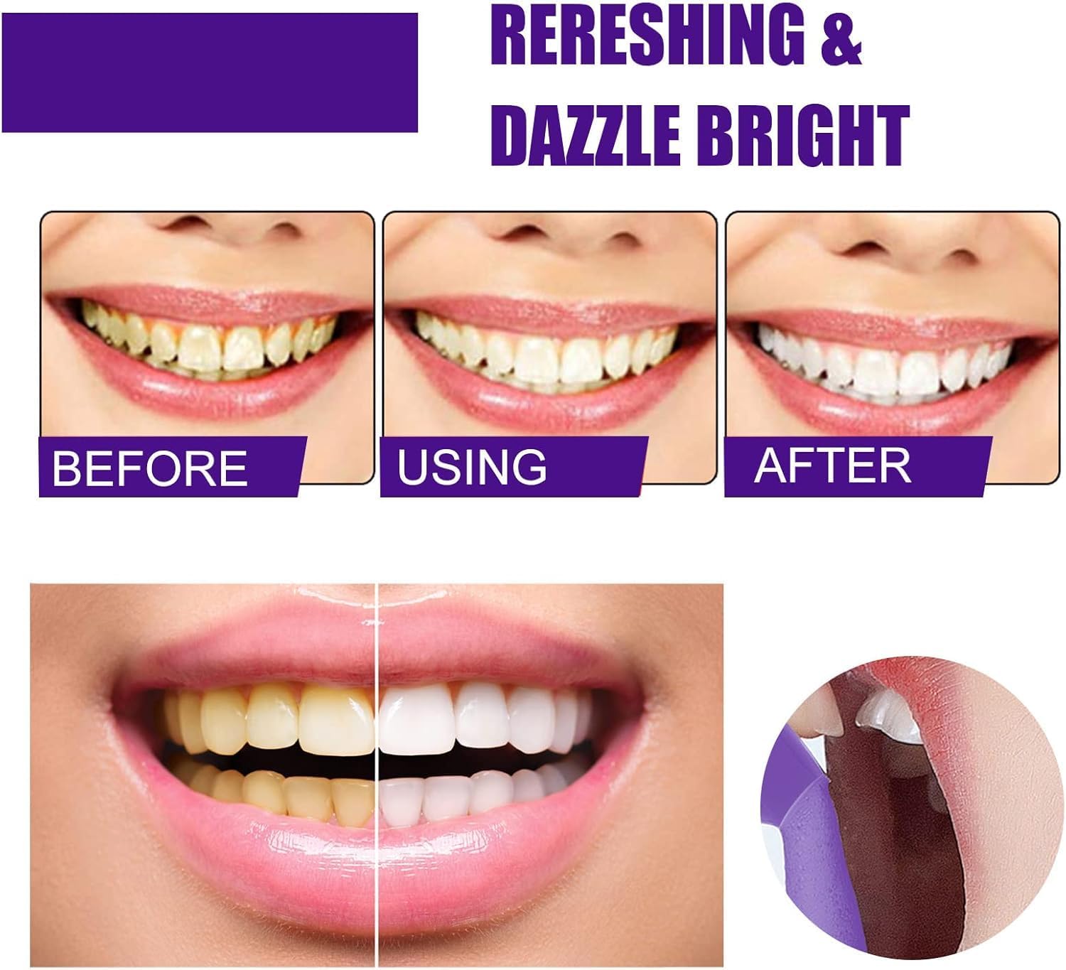 Purple Foaming Teeth Whitening - đánh giá và giá Teeth Whitening Routine