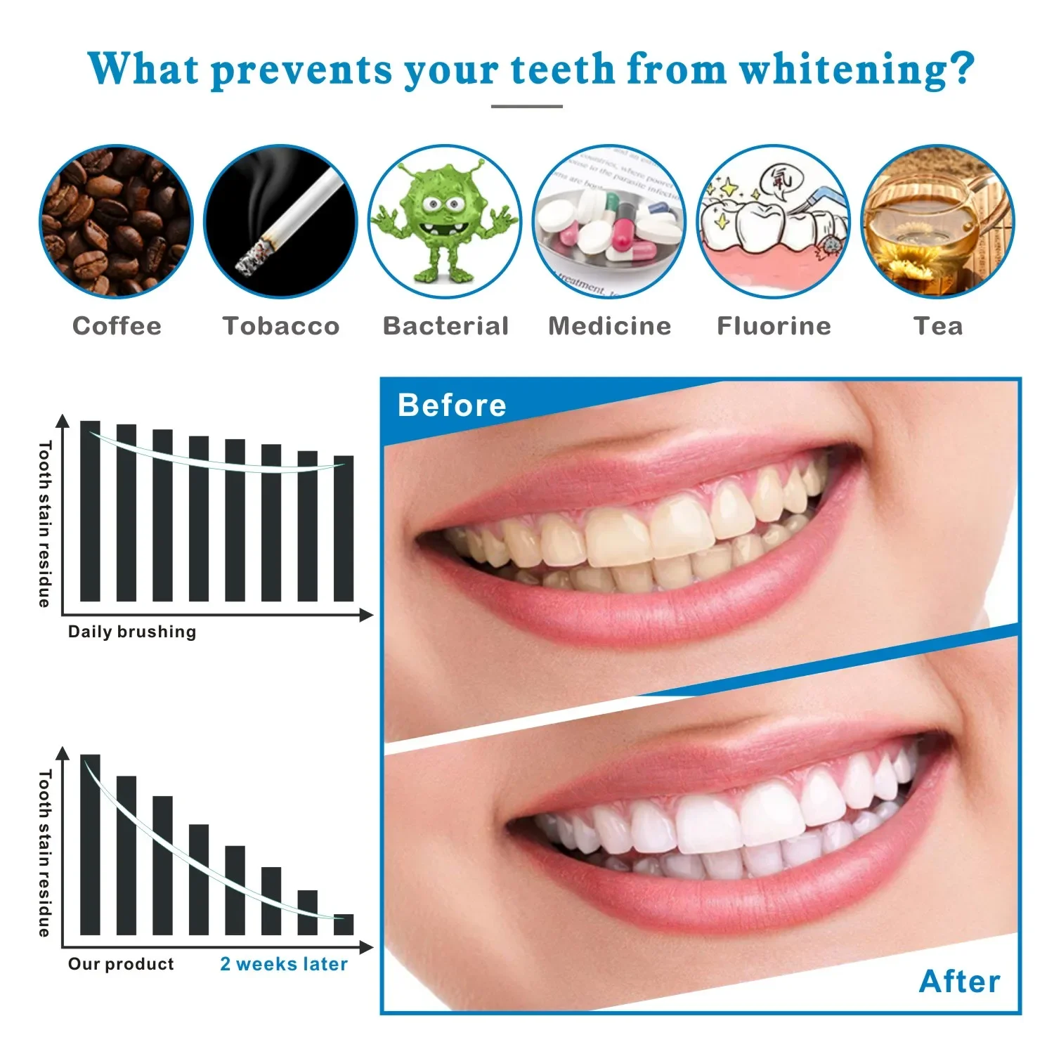 14/28pcs 3D Teeth Whitening St - đánh giá và giá Whitening Strip 3D