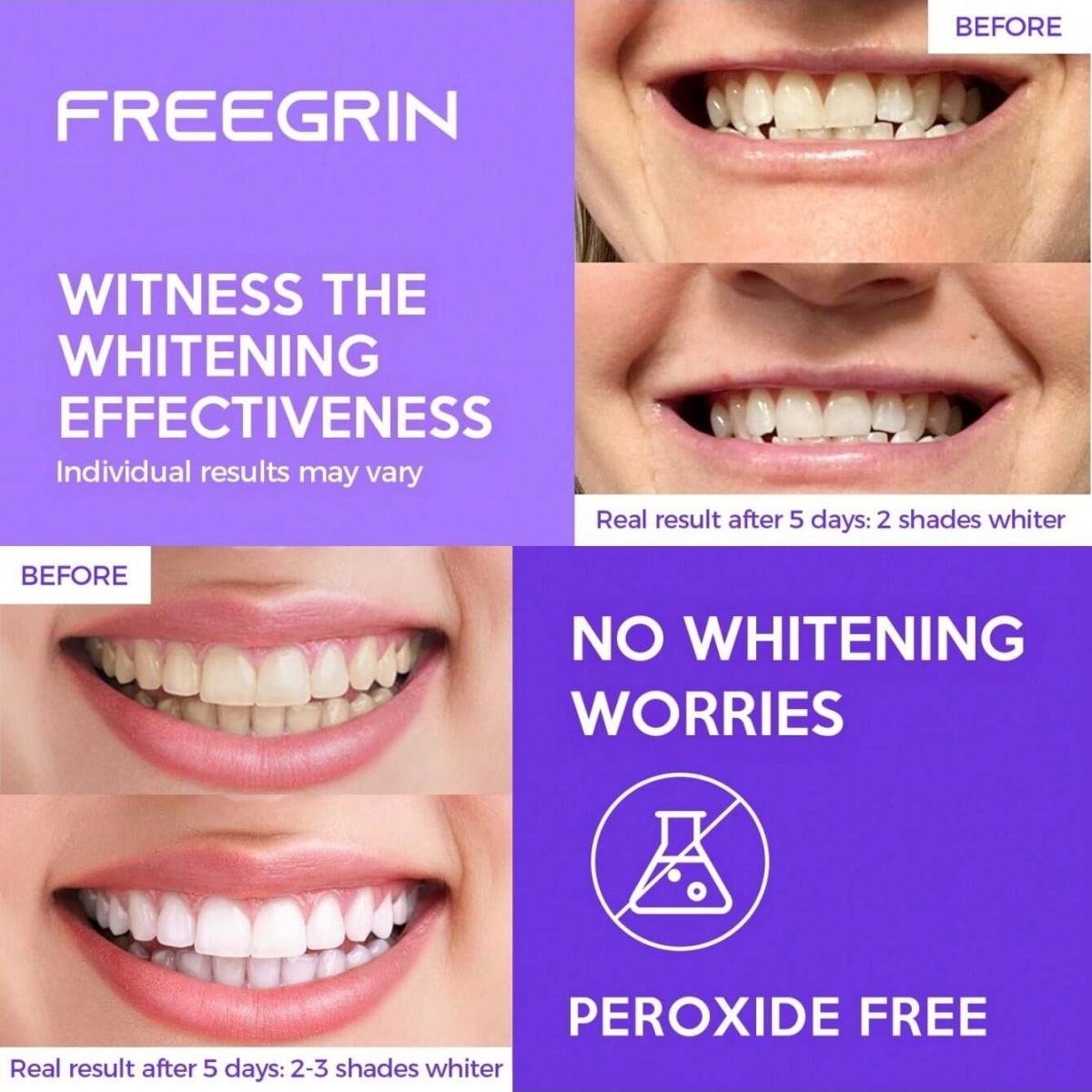 Deluxe Whitening Teeth Sticker - đánh giá và giá Teeth Whitening Essence